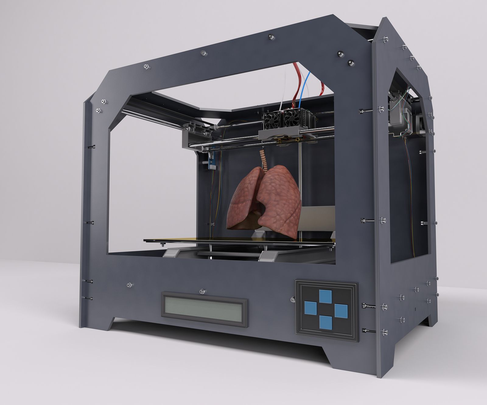 La impresión 3D en cirugía torácica mejora la planificación y optimiza el tiempo de las operaciones