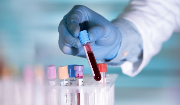 Un análisis de sangre puede calcular la edad real de nuestros órganos y cuál está más envejecido