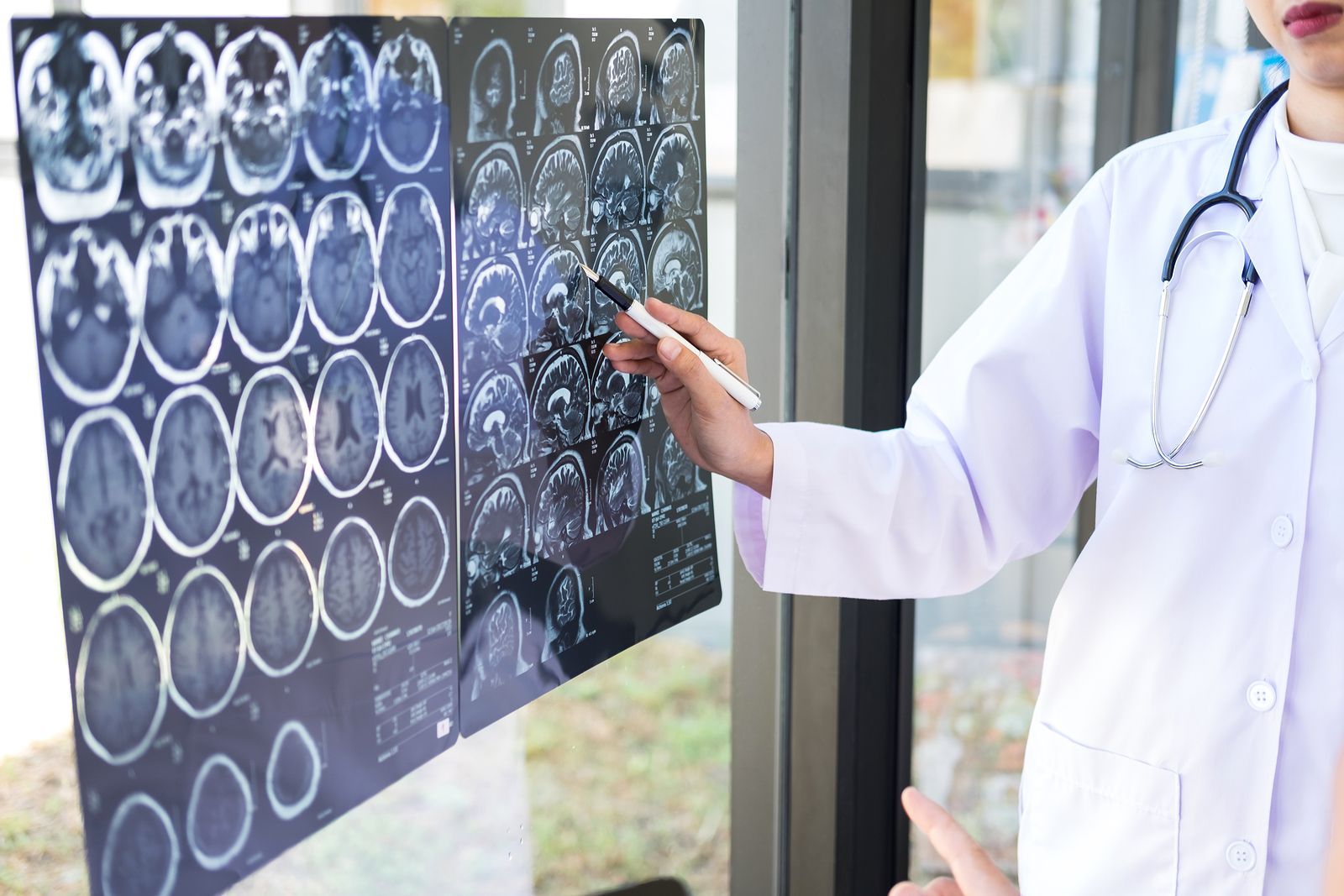 Radiología intervencionista