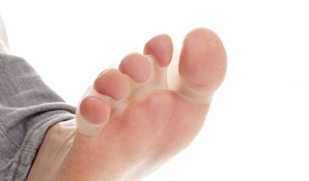 Podóloga desaconseja los separadores de dedos: "Las correcciones en adultos no existen"