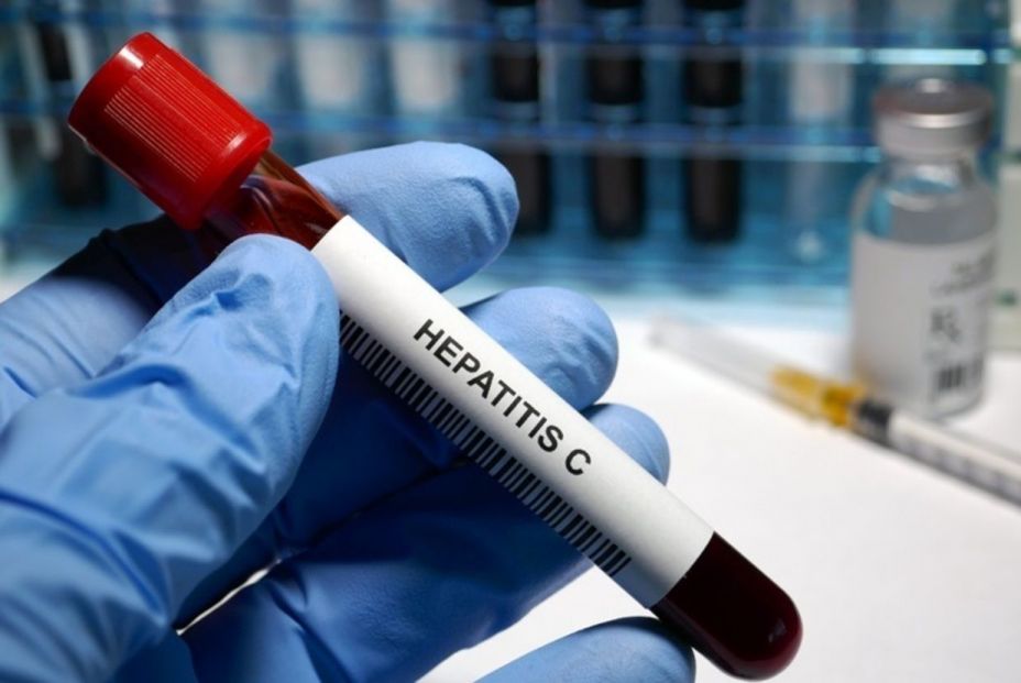 Eliminar espontáneamente la hepatitis C produce más riesgo de sufrir enfermedades (Europa Press)