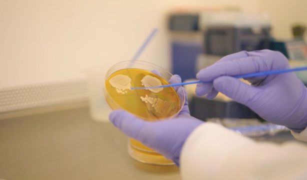Una nueva levadura alimentada por luz proporciona información sobre el envejecimiento