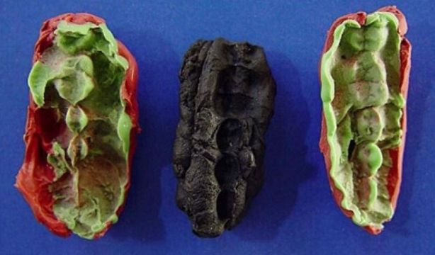 Chicles de hace 10.000 años revelan la dieta de la Edad de Piedra