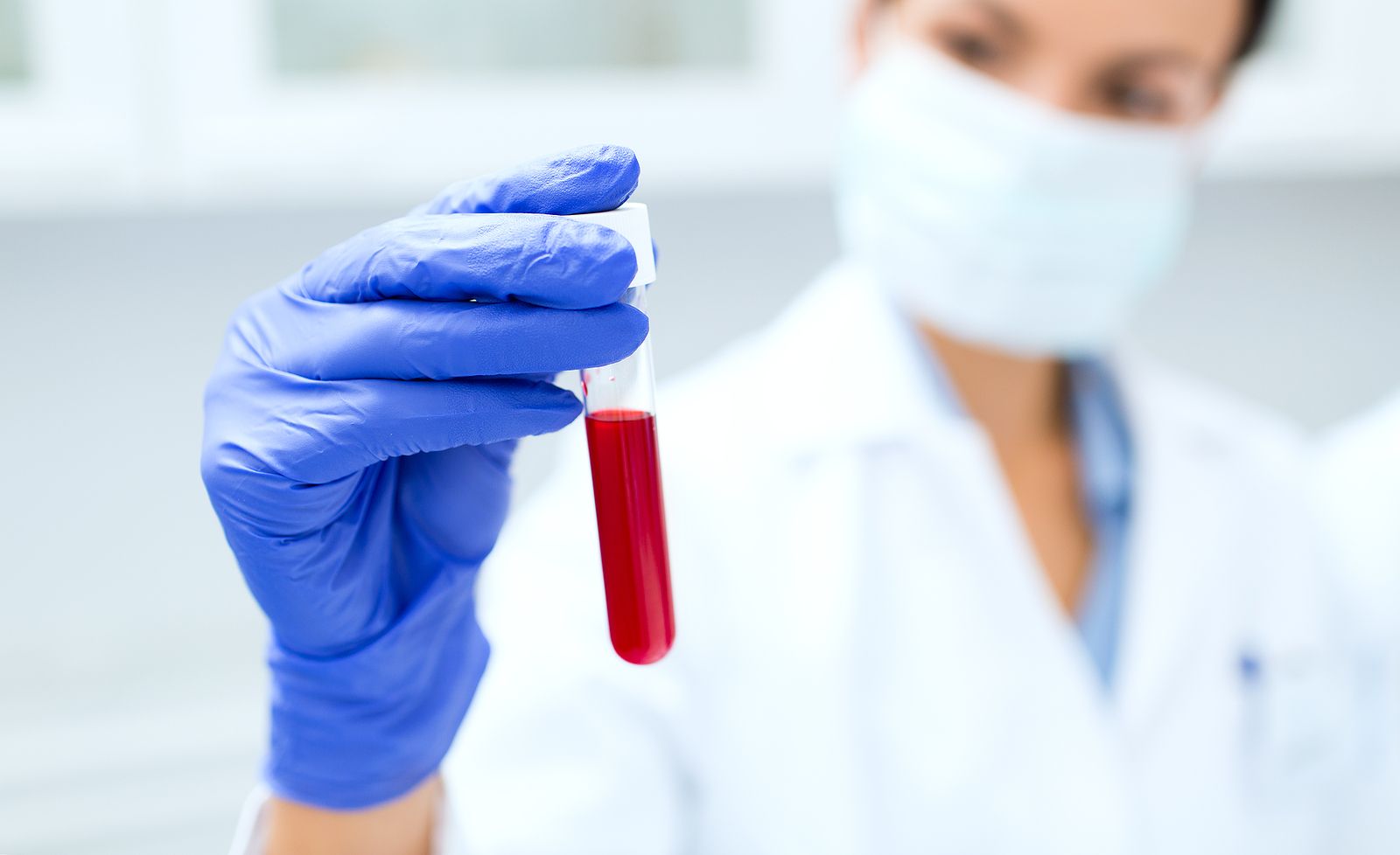 Desarrollan una analítica de sangre que puede diagnosticar el alzhéimer con una precisión del 90%