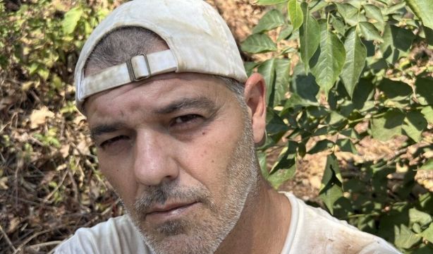 Frank Cuesta, a punto de morir por el ataque de un ciervo: "Tengo heridas por todos lados"
