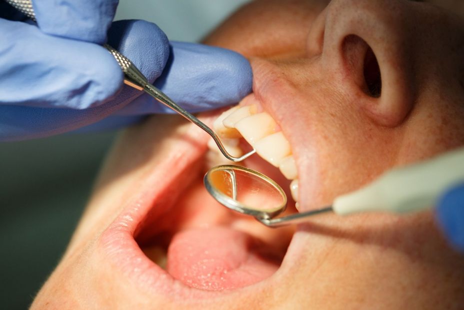 Las caries en personas mayores no se tratan en la mayoría de los casos, alertan los dentistas