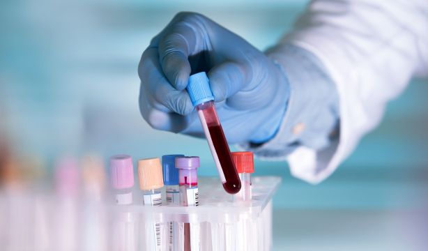 Descubren que un análisis de sangre puede predecir un ataque cardíaco seis meses antes de que ocurra (Bigstock)