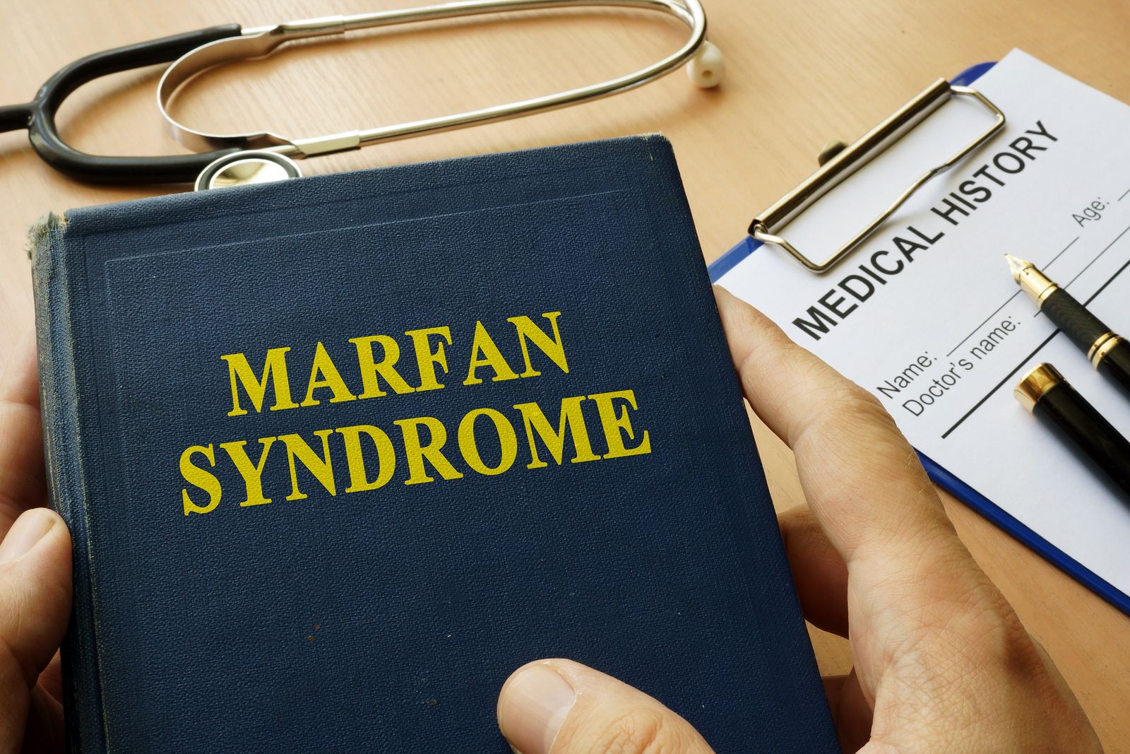 Qué es el Síndrome de Marfan Qué es el Síndrome de Marfan