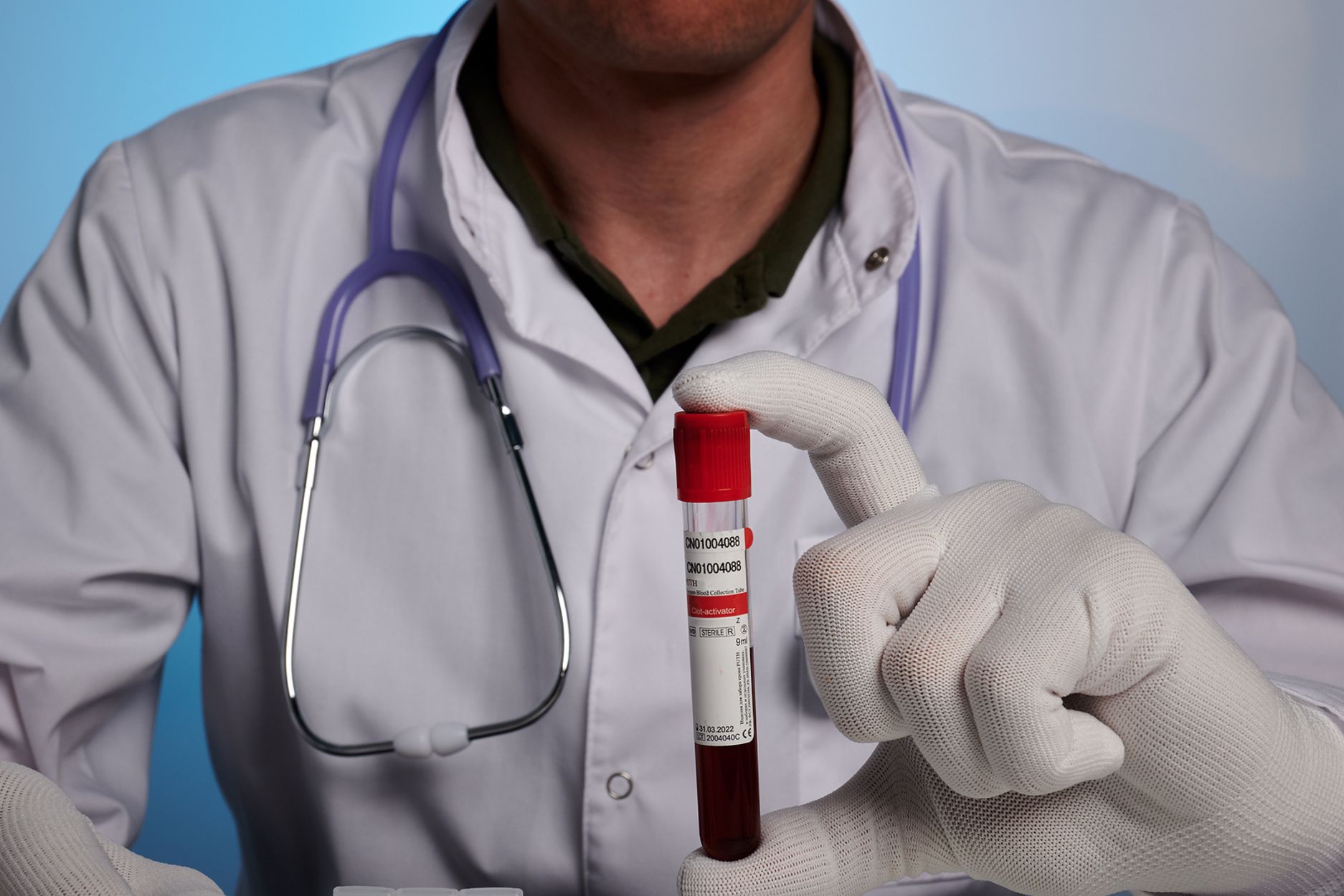 Un análisis de sangre consigue detectar el cáncer de colon en el 83% de los casos