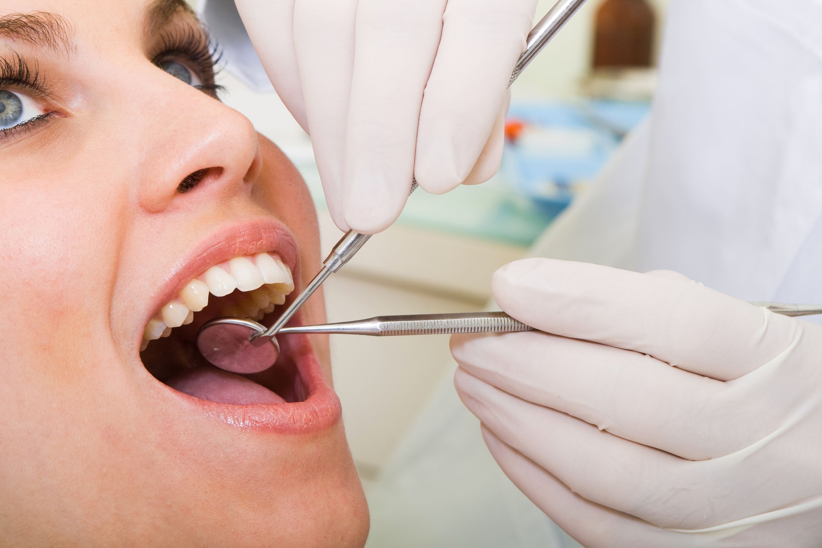 Alertan de los riesgos de hacerse tratamientos dentales a través de Internet o 'influencers' (Bigstock)