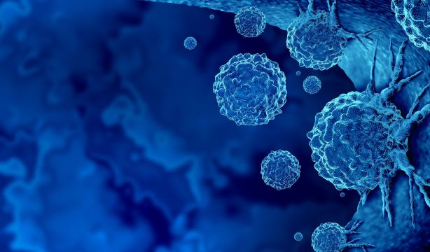 Los tipos de cáncer más frecuentes en España en hombres y mujeres y cómo prevenirlos (Bigstock)