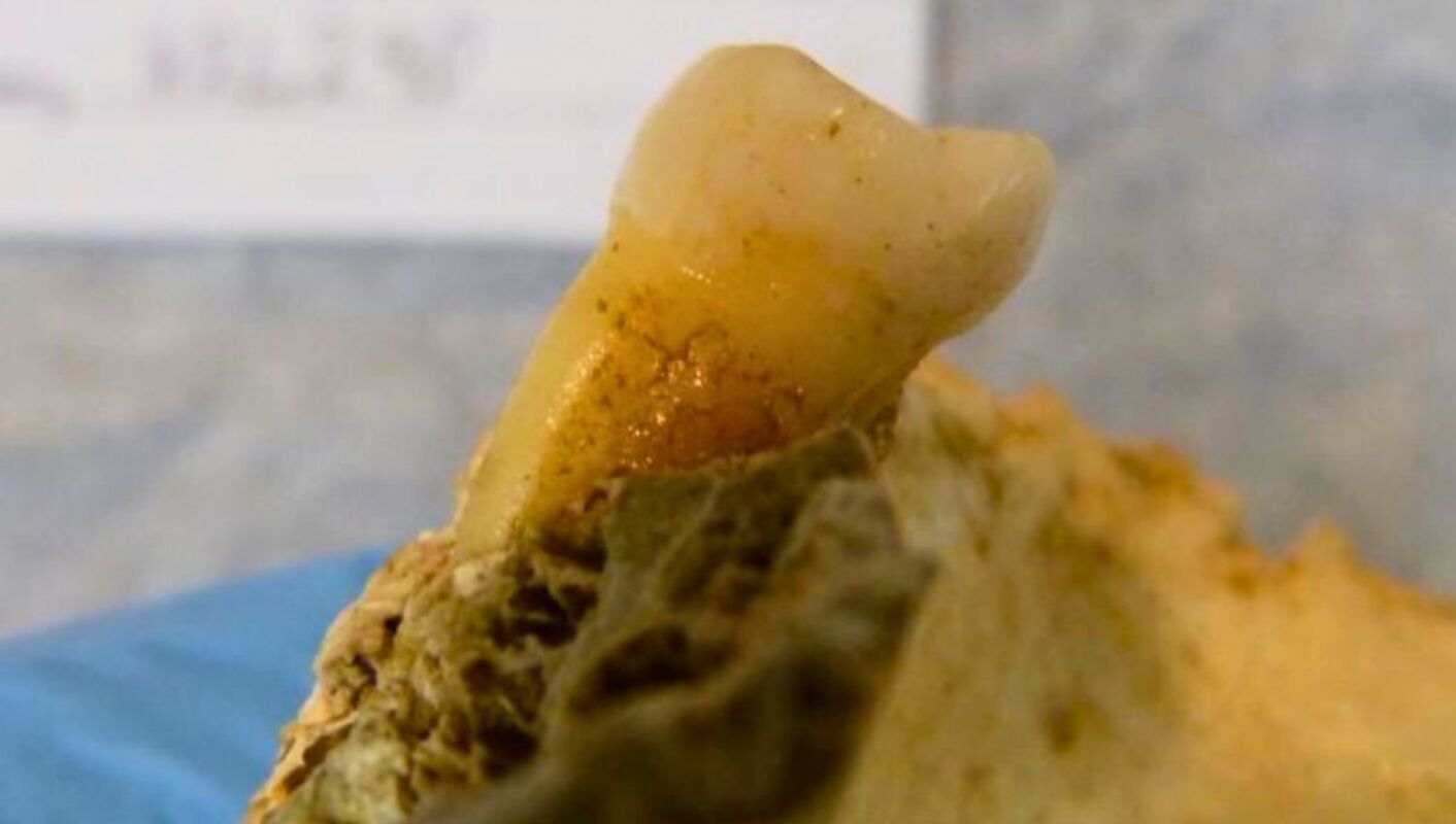 Hallazgos en dientes de la Edad de Bronce permiten analizar la evolución de la dieta humana