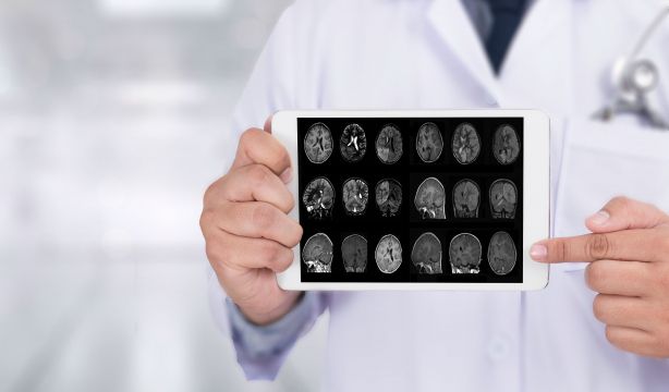 La región cerebral que construye la identidad se forma antes de nacer:  ¿qué ocurre en el Alzhéimer?