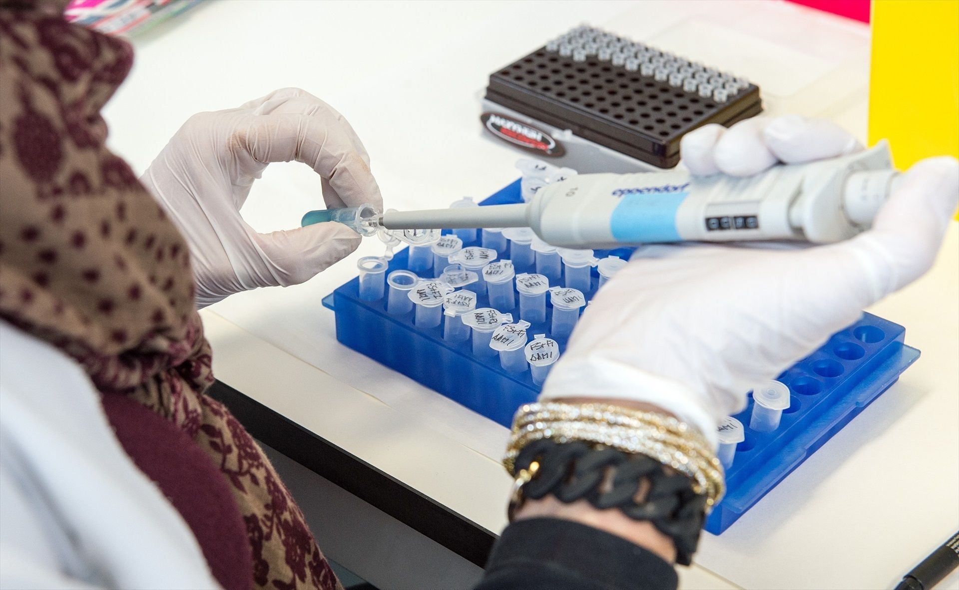 Crean un hidrogel que podría servir para reparar lesiones medulares (Europa Press)
