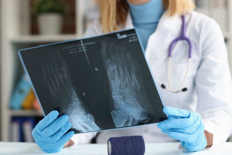La Enfermedad de Freiberg: si tus pies tienen esta forma deberías alarmarte. bigstock La Enfermedad de Freiberg: si tus pies tienen esta forma deberías alarmarte. bigstock