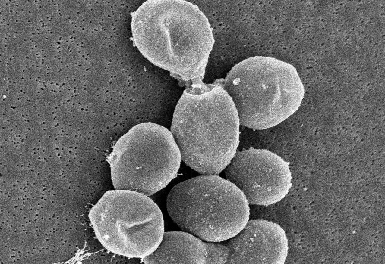 Descubren un método para producir serotonina a partir de la levadura del vino