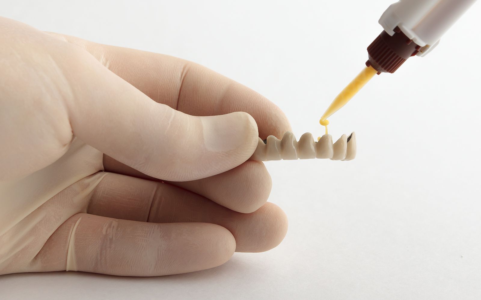 Adhesivos para prótesis dentales