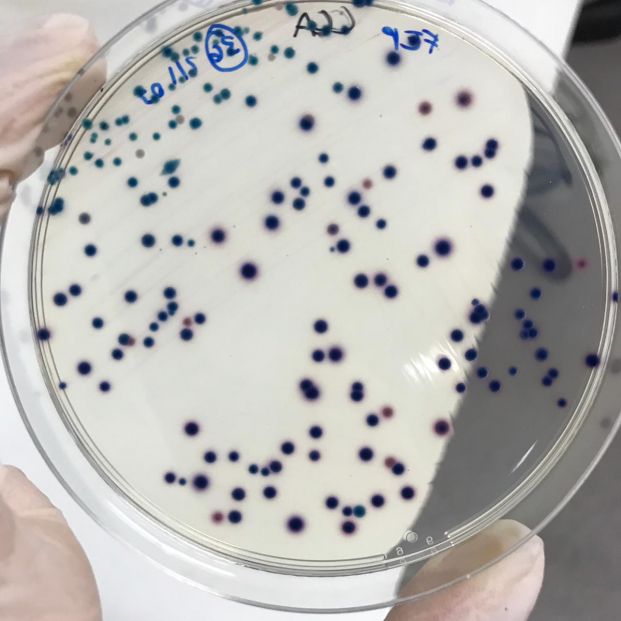 ¿Cómo afecta la listeriosis a las personas mayores? ¿Cómo afecta la listeriosis a las personas mayores?