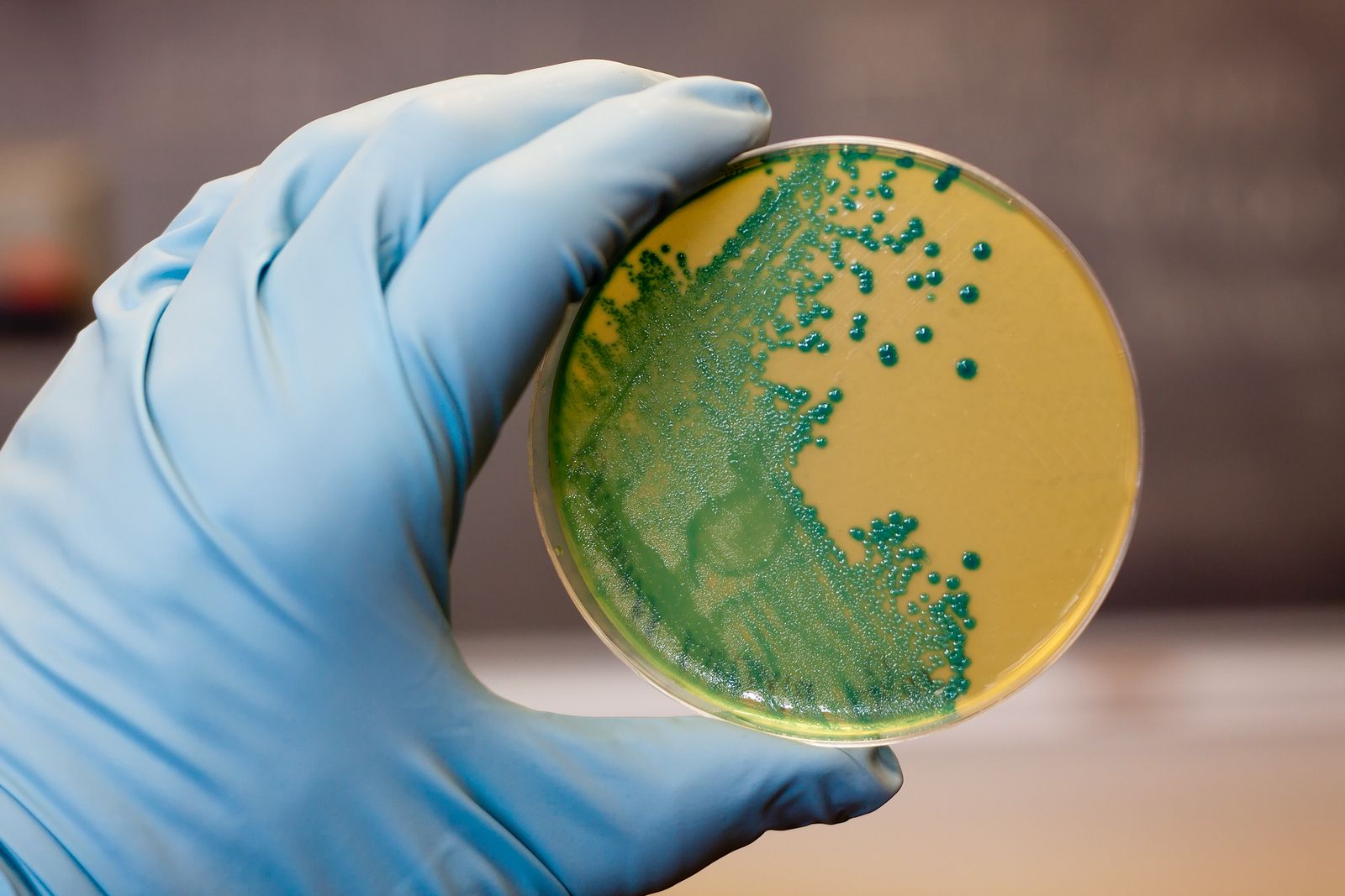 bigstock Listeria Bacteria 21851567