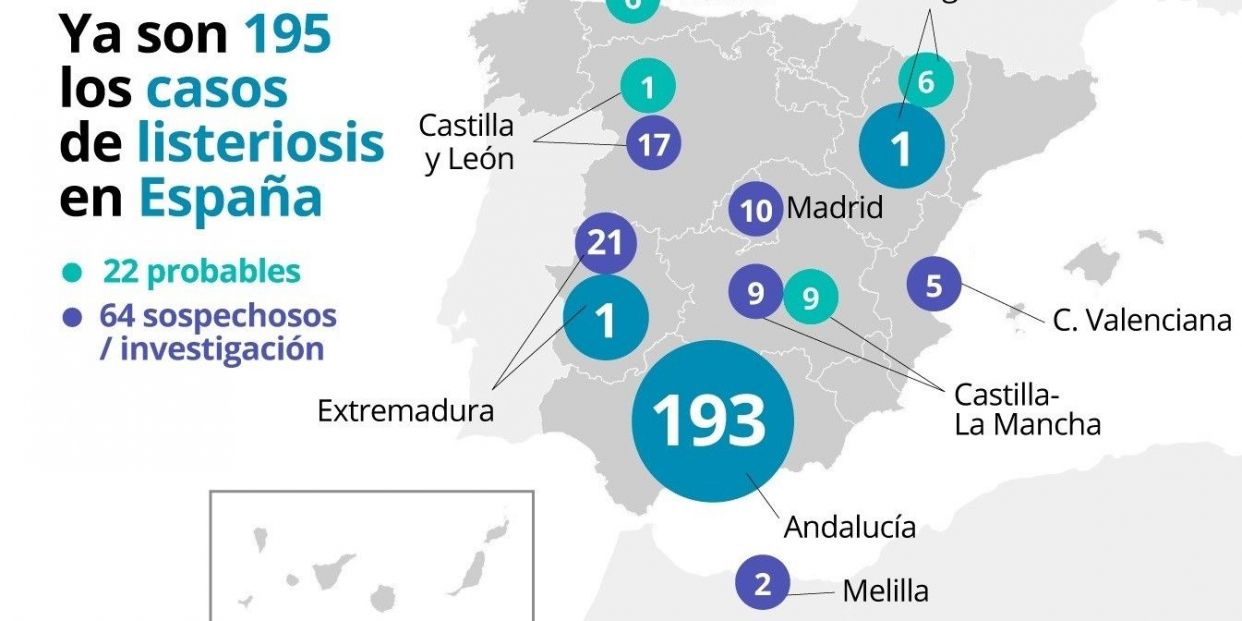 EuropaPress 2336675 Casos de listeriosis en España el 26 de agosto de 2019 EuropaPress 2336675 Casos de listeriosis en España el 26 de agosto de 2019
