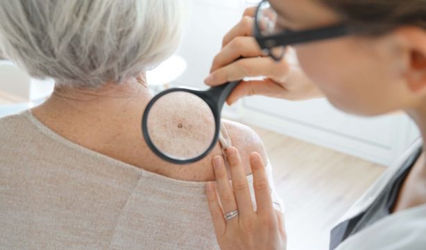 Descubren una nueva estrategia para combatir metástasis cerebrales del cáncer de piel más agresivo