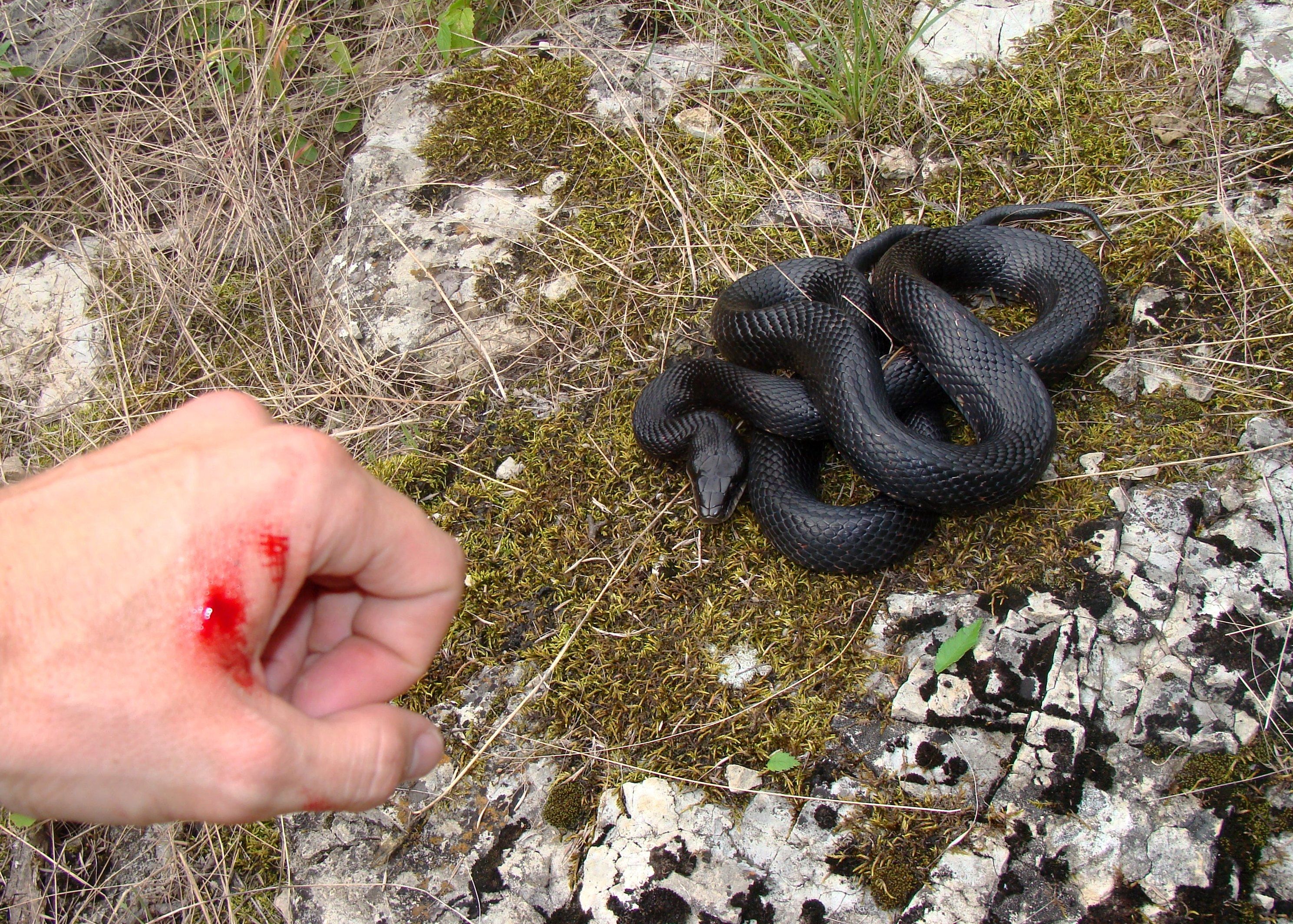 Mordedura de serpiente