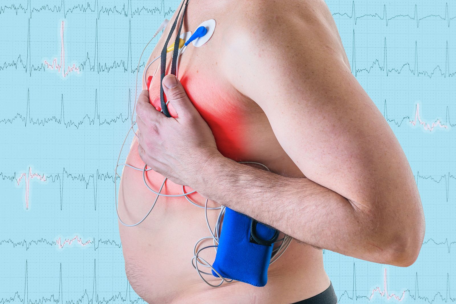 Sistema Holter Sistema Holter