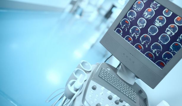 Necesitamos tu ayuda para tratar pacientes con ictus agudo