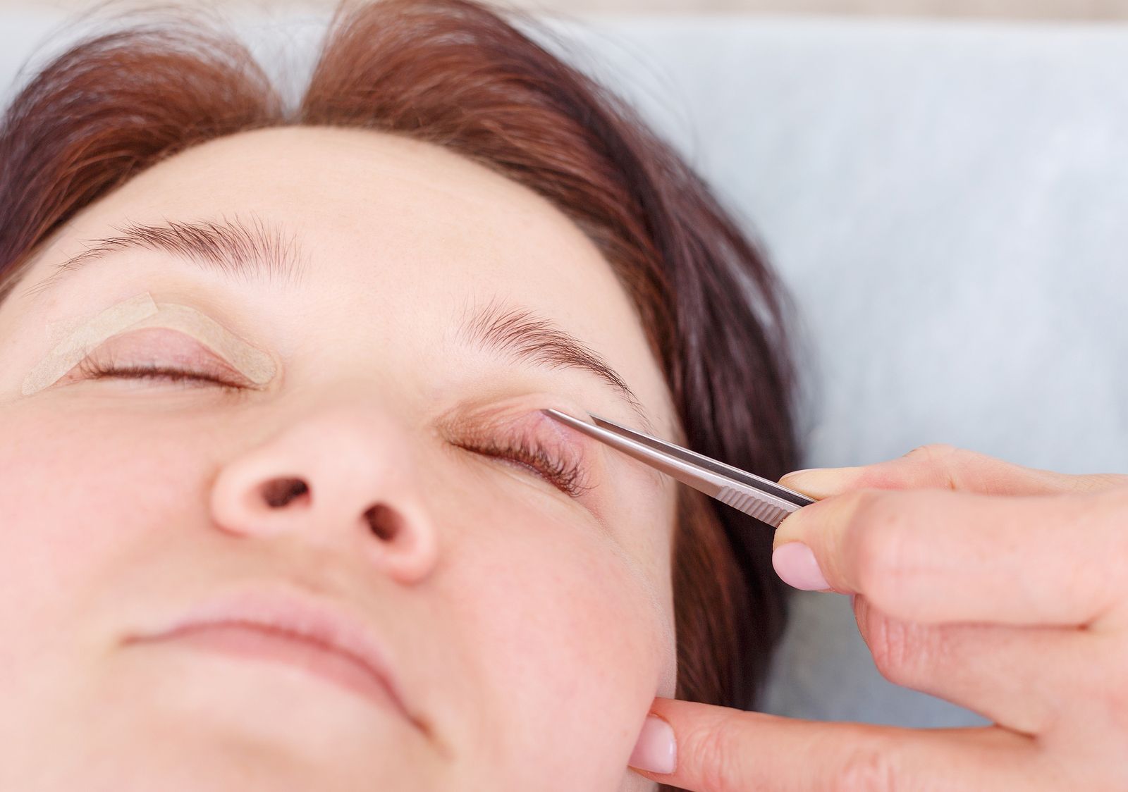 Cuándo se puede producir una ptosis palpebral y cómo afecta a los mayores Cuándo se puede producir una ptosis palpebral y cómo afecta a los mayores