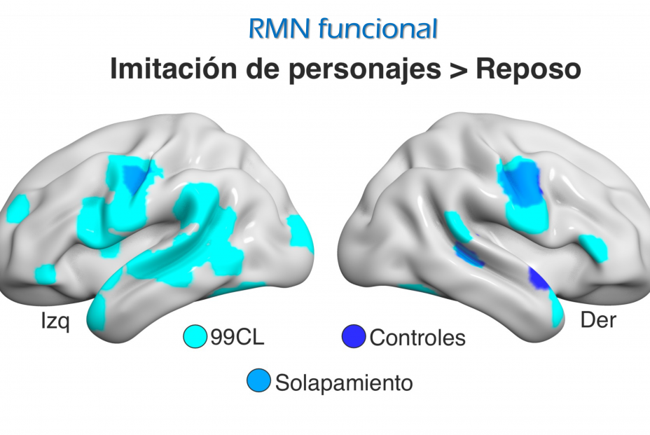 Foto de resonancia magnética funcional. Fuente: UMA