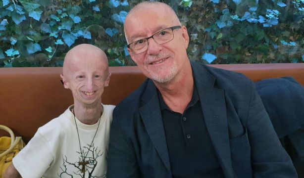 Un poco de luz sobre la progeria, la enfermedad que acelera el envejecimiento prematuro. Fuente: Europa Press