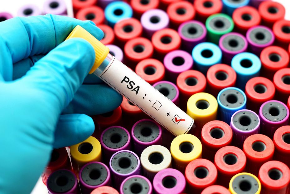 ¿Exceso de terapia en los mayores con cáncer de próstata? BigStox ¿Exceso de terapia en los mayores con cáncer de próstata? BigStox