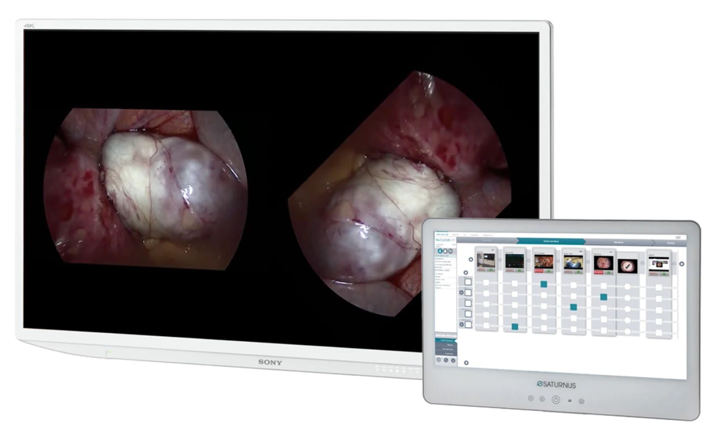 NUCLeUS: plataforma inteligente de imágenes médicas