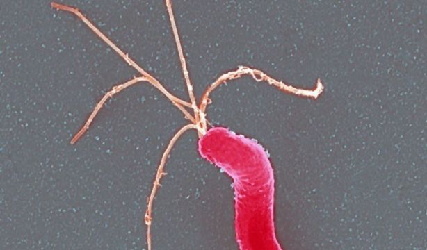 Descubren una nueva terapia para erradicar el Helicobacter pylori