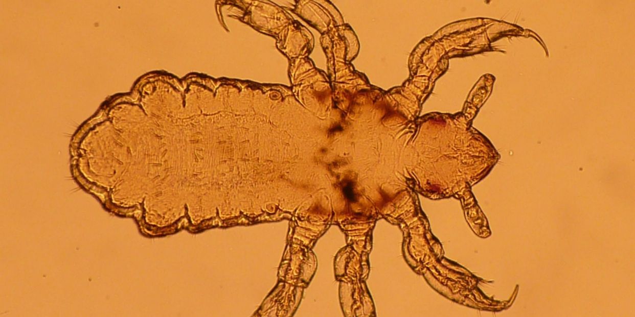 Piojos en adultos cómo eliminarlos y prevenirlos
