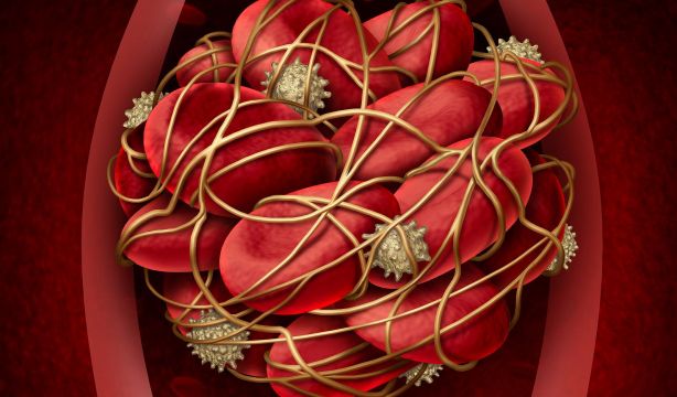 La exposición a luz roja disminuye el riesgo de coágulos sanguíneos