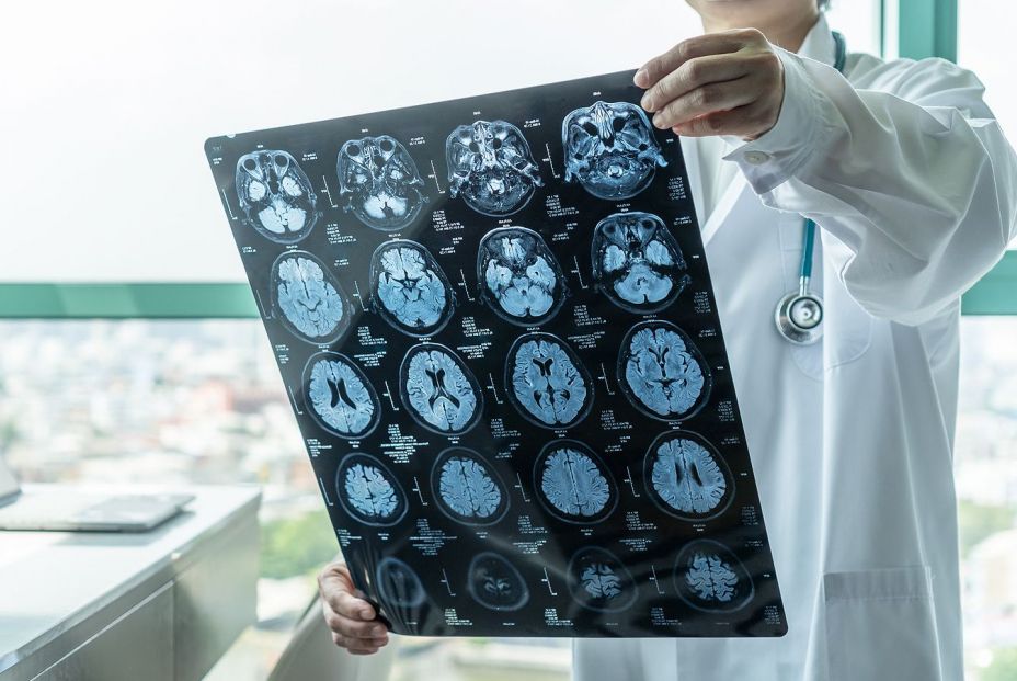 Investigadores encuentran una relación entre el barrio donde vives y el estado de tu cerebro Investigadores encuentran una relación entre el barrio donde vives y el estado de tu cerebro