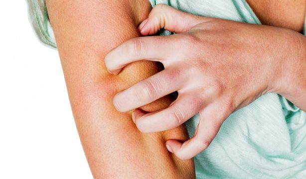 La paradoja de rascarse cuando pica: agrava la inflamación, pero protege contra infecciones