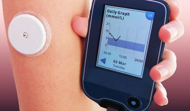 ¿Son fiables los monitores continuos de glucosa?