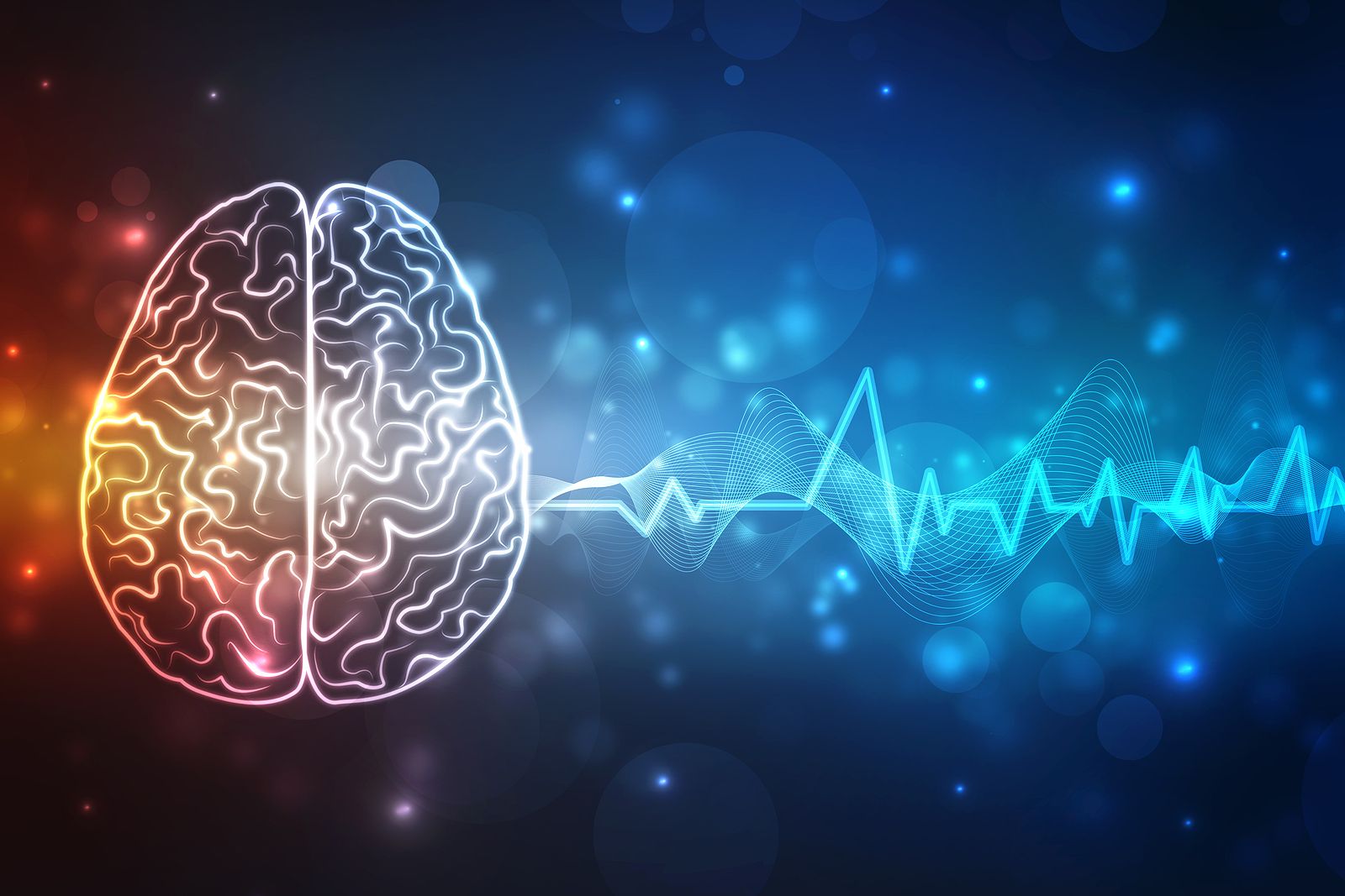 Los 8 pasos esenciales para proteger la salud cerebral (Bigstock) Los 8 pasos esenciales para proteger la salud cerebral (Bigstock)