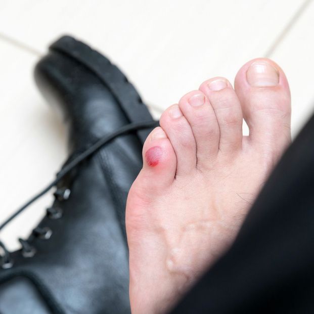 bigstock Bloody Terrible Blister On Hum 286152355 bigstock Bloody Terrible Blister On Hum 286152355