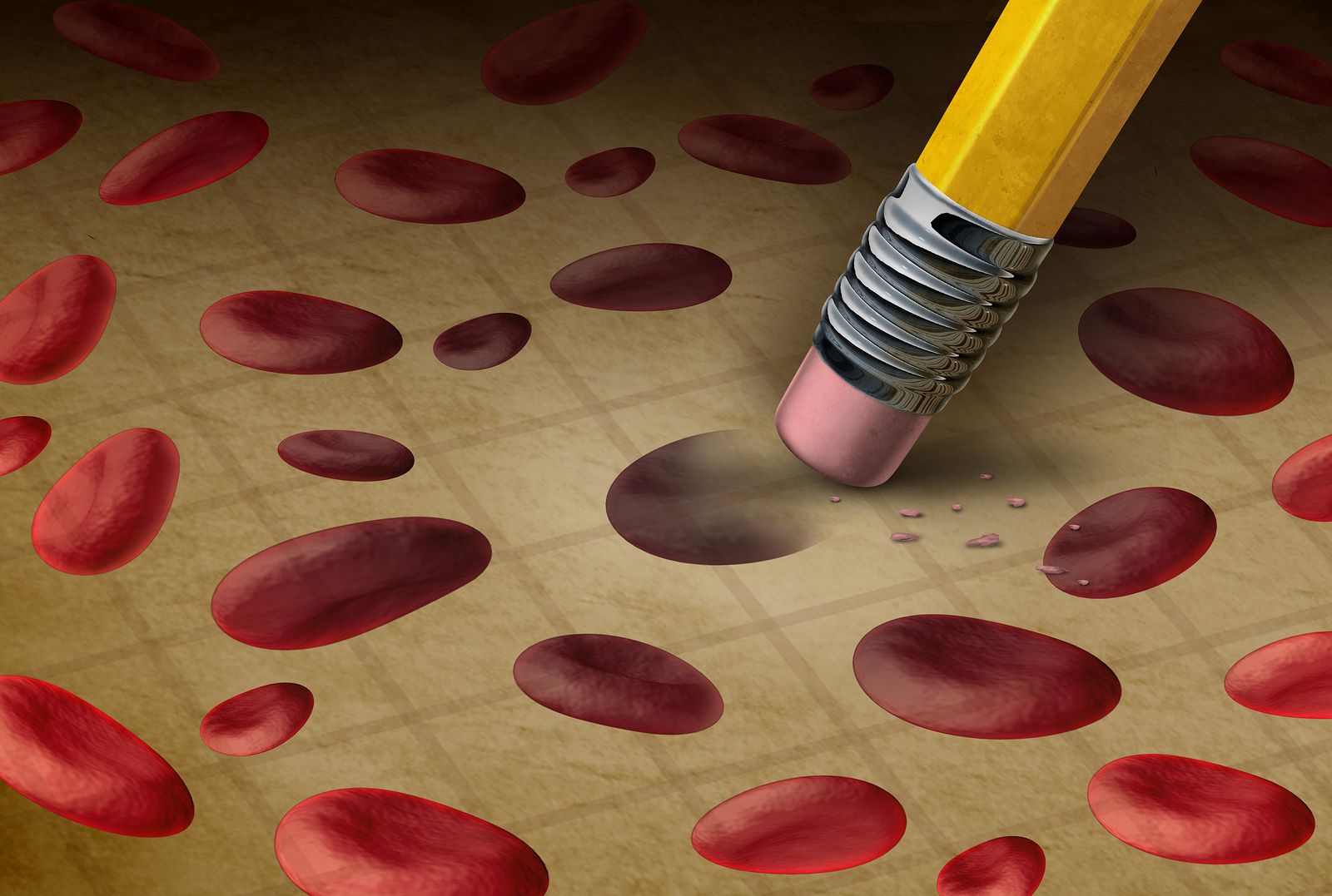 Síntomas para detectar la anemia en mayores