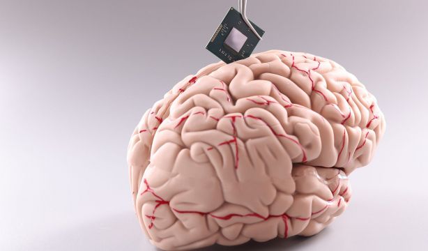 Así se podrá permitir que las víctimas de accidentes cerebrovasculares 'hablen'. Bigstock