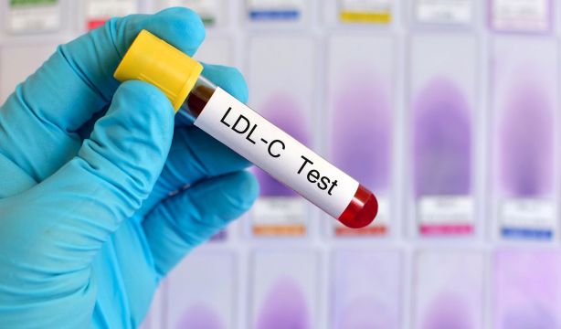 Lo último que dice la ciencia del 'famoso' colesterol y tu salud. Bigstock