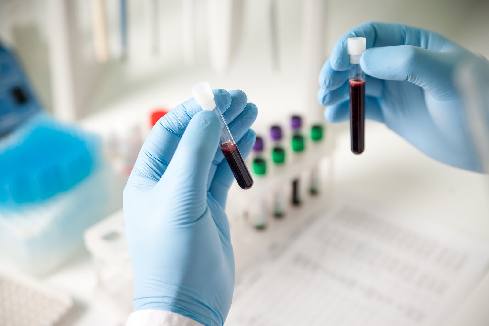 Un estudio identifica 56 sustancias en la sangre relacionadas con el envejecimiento Un estudio identifica 56 sustancias en la sangre relacionadas con el envejecimiento
