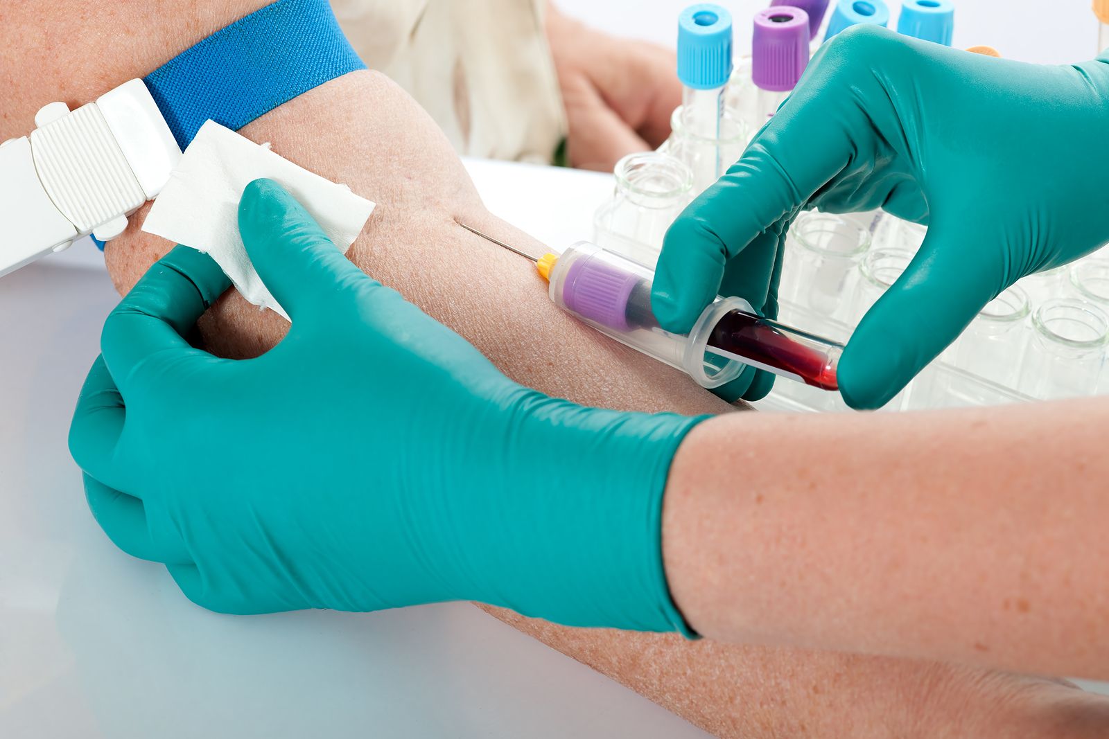 Una nueva prueba de sangre detecta más de 20 tipos de cáncer en etapas tempranas