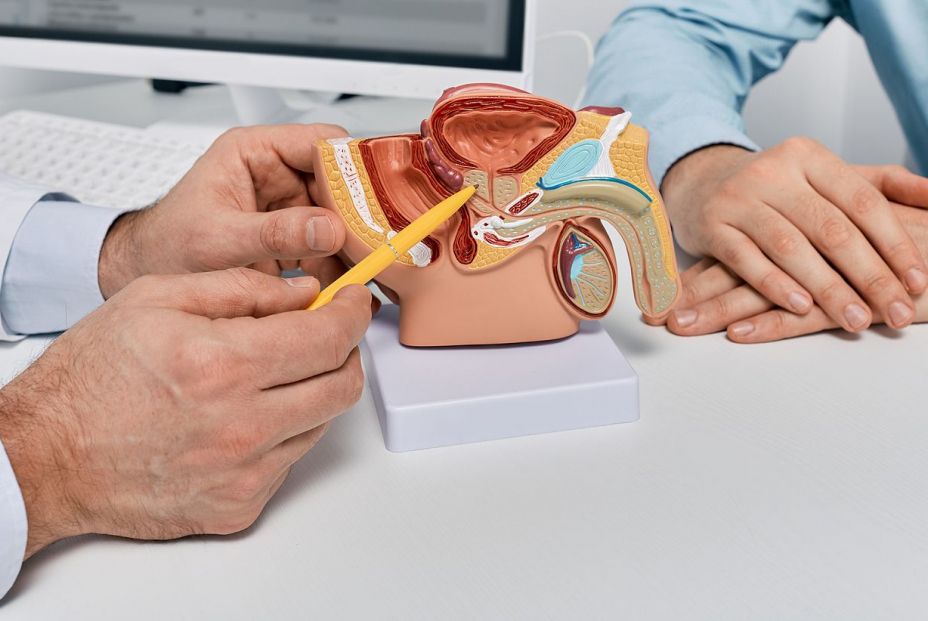 A nivel mundial el cáncer de próstata es el segundo más frecuente en varones. Bigstock A nivel mundial el cáncer de próstata es el segundo más frecuente en varones. Bigstock
