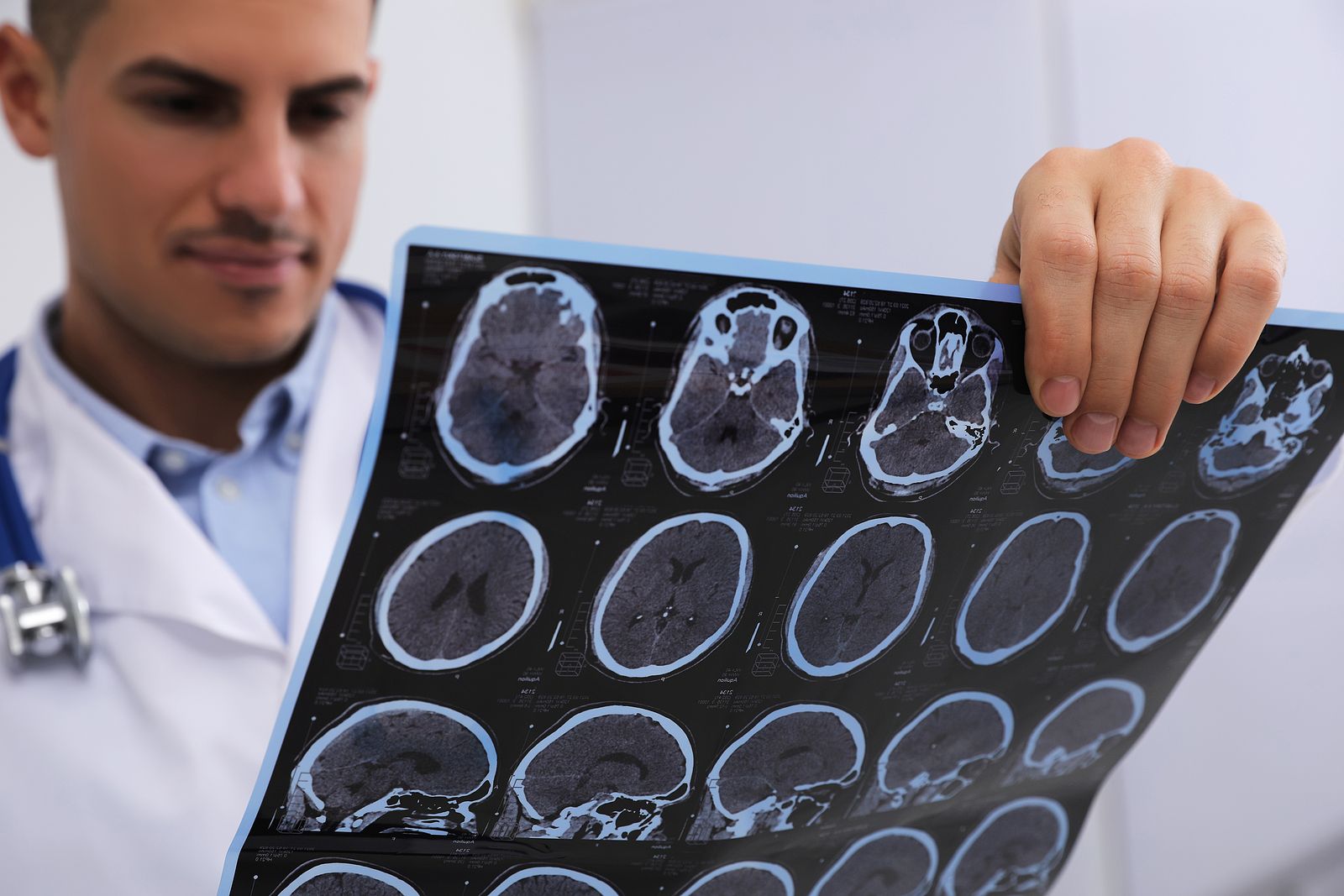 El retraso medio del diagnóstico de la esclerosis múltiple en España es de dos años (Bigstock() El retraso medio del diagnóstico de la esclerosis múltiple en España es de dos años (Bigstock()