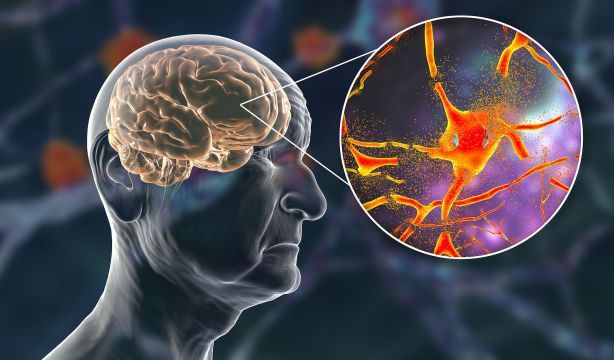 Qué son las chaperonas y por qué podrían ser claves en la progresión del alzhéimer