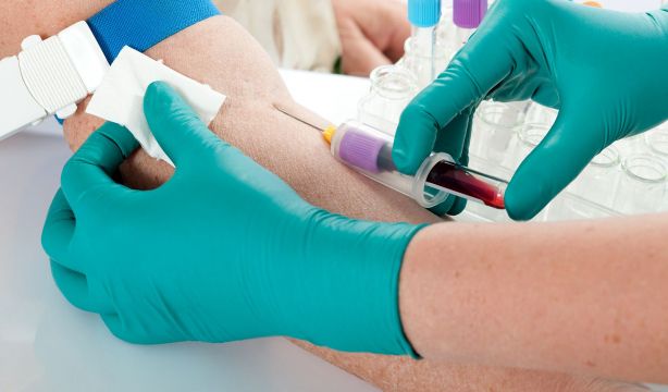 Un experto en longevidad señala 4 análisis de sangre que todo el mundo se debería hacer